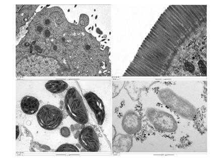 超薄切片+透射电镜（Bio-TEM）